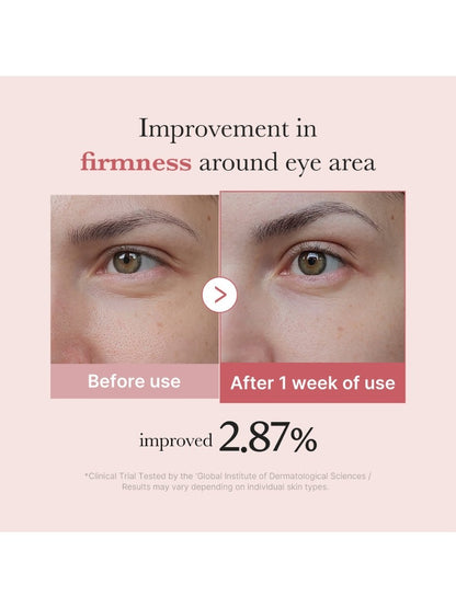 Medicube PDRN Pink Peptide Eye Cream 30ml- Κρέμα ματιών με ρετινόλη και pdrn