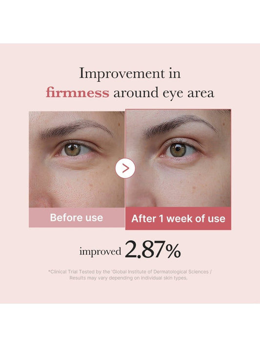 Medicube PDRN Pink Peptide Eye Cream 30ml- Κρέμα ματιών με ρετινόλη και pdrn